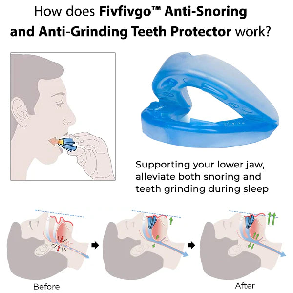 Anti-snoring and anti-teeth-grinding night guard protector